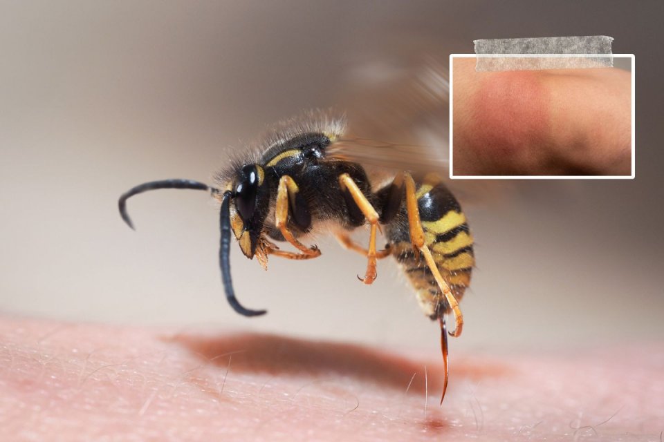 Zo voorkom, herken en behandel je een wespensteek. Foto: Getty Images