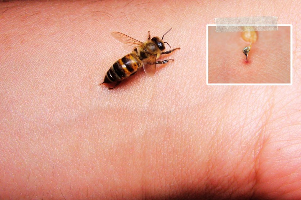 Zo voorkom, herken en behandel je een bijensteek. Foto: Getty Images